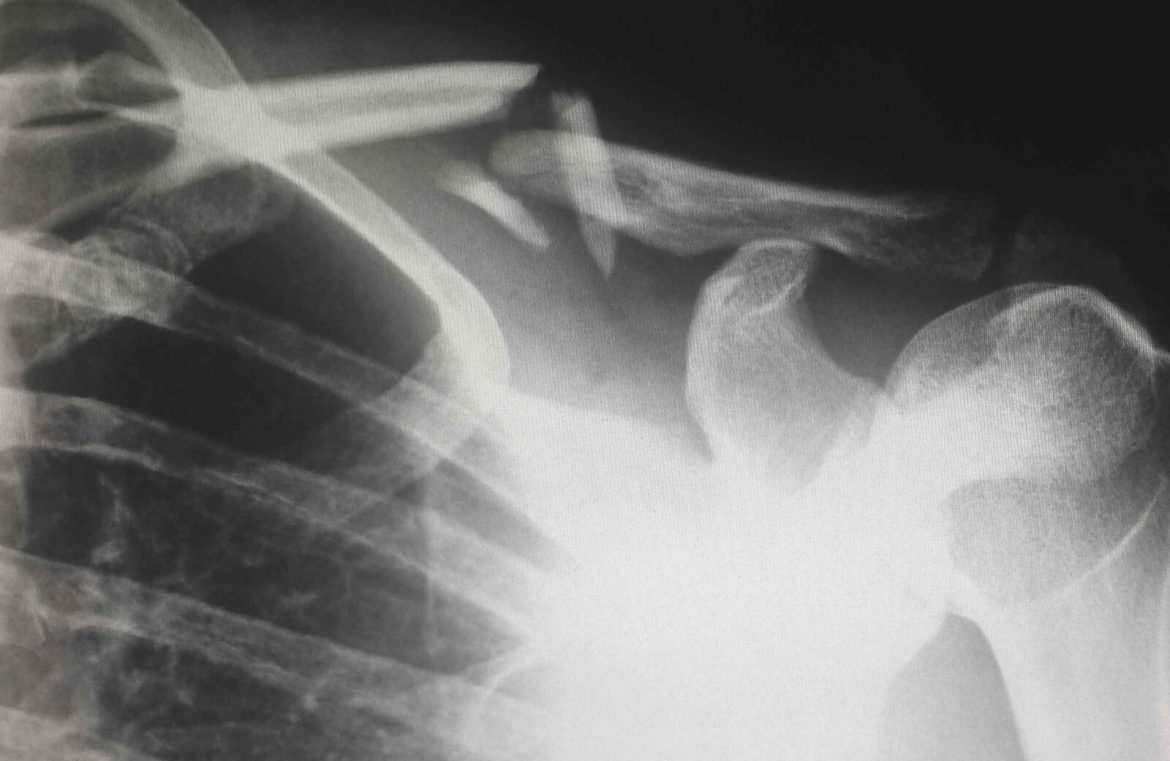 featured_tragedy_c764524587aa464c671576b8540b19f1